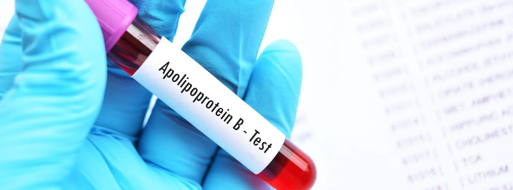 What’s apolipoprotein B (ApoB) and why should you care? | Step One Foods