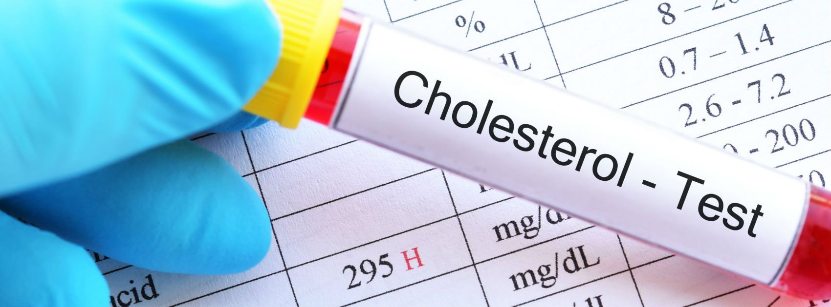 Cholesterol store level normal